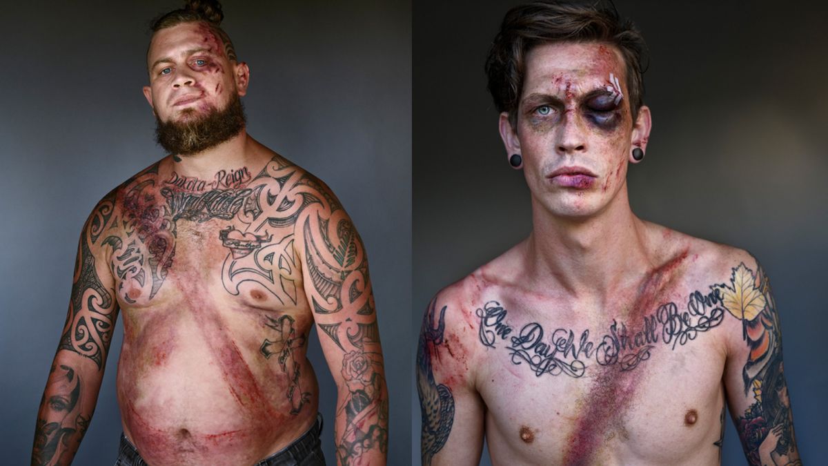 Graphic Portrait Series of Crash Survivors Highlights the Importance of Wearing Seatbelts